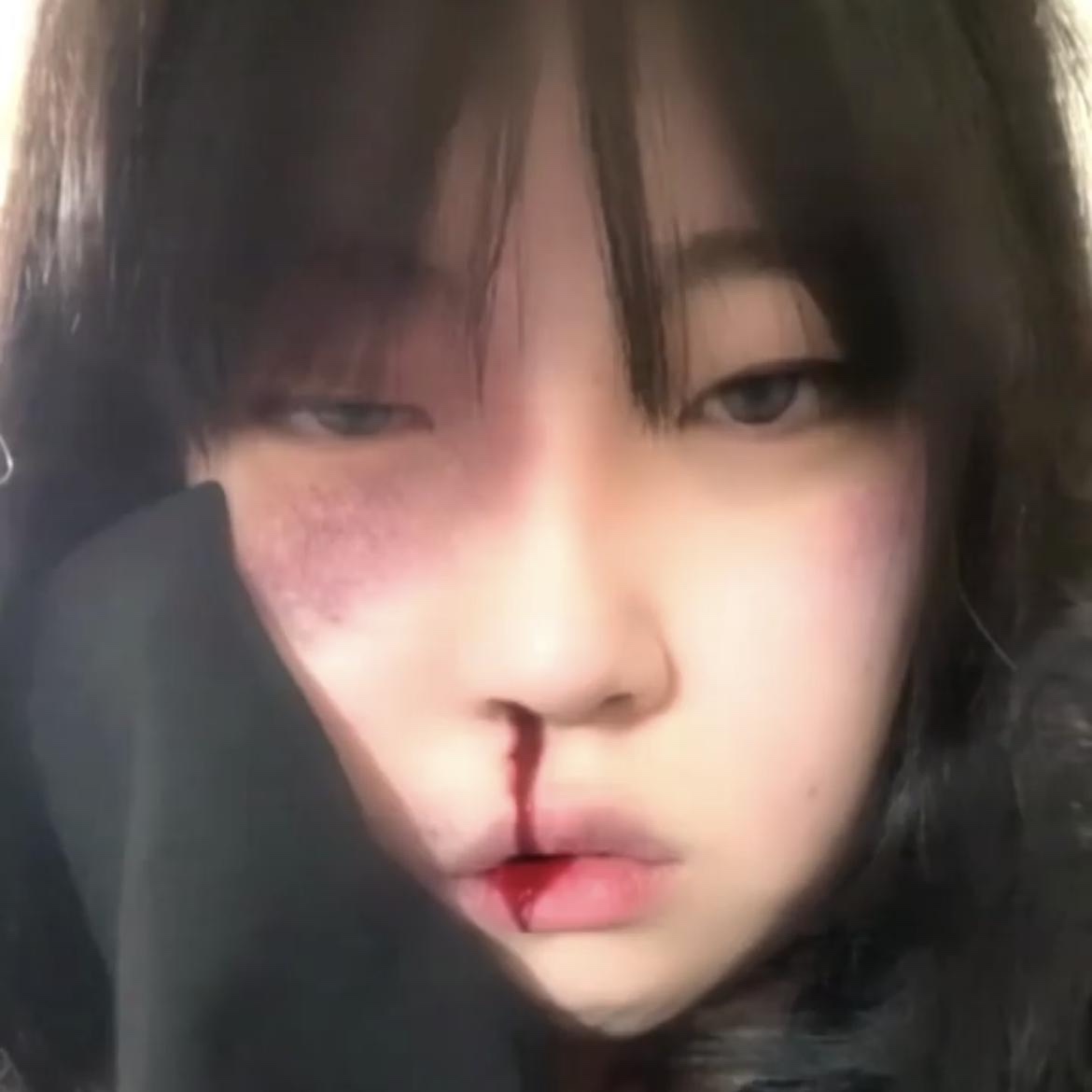 블로그 이미지